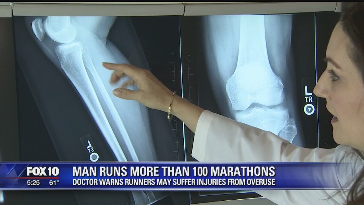 Doctor: Runners may suffer injuries from overuse