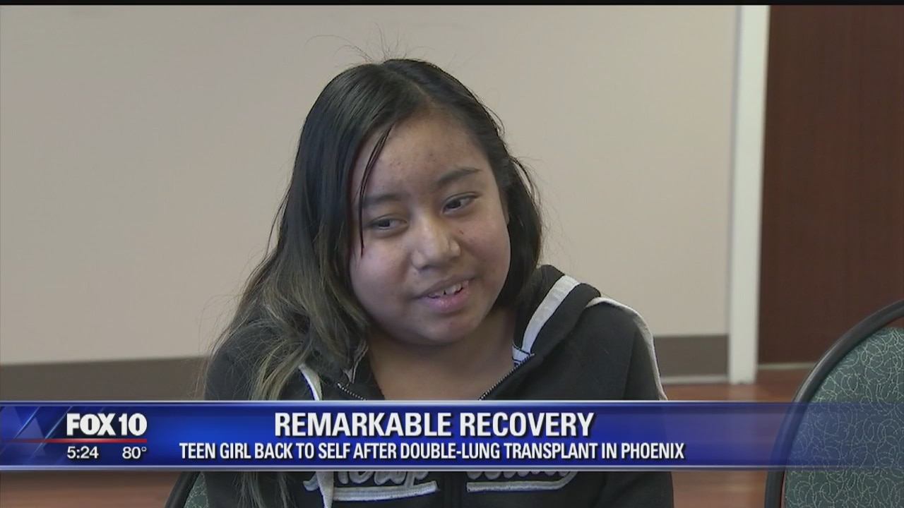 Las Vegas teen looks back at life-changing surgery in Phoenix