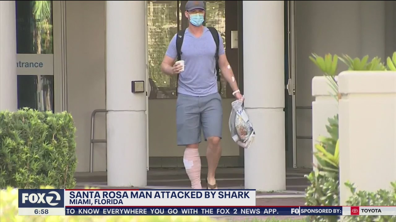 Santa Rosa man is OK after shark bite