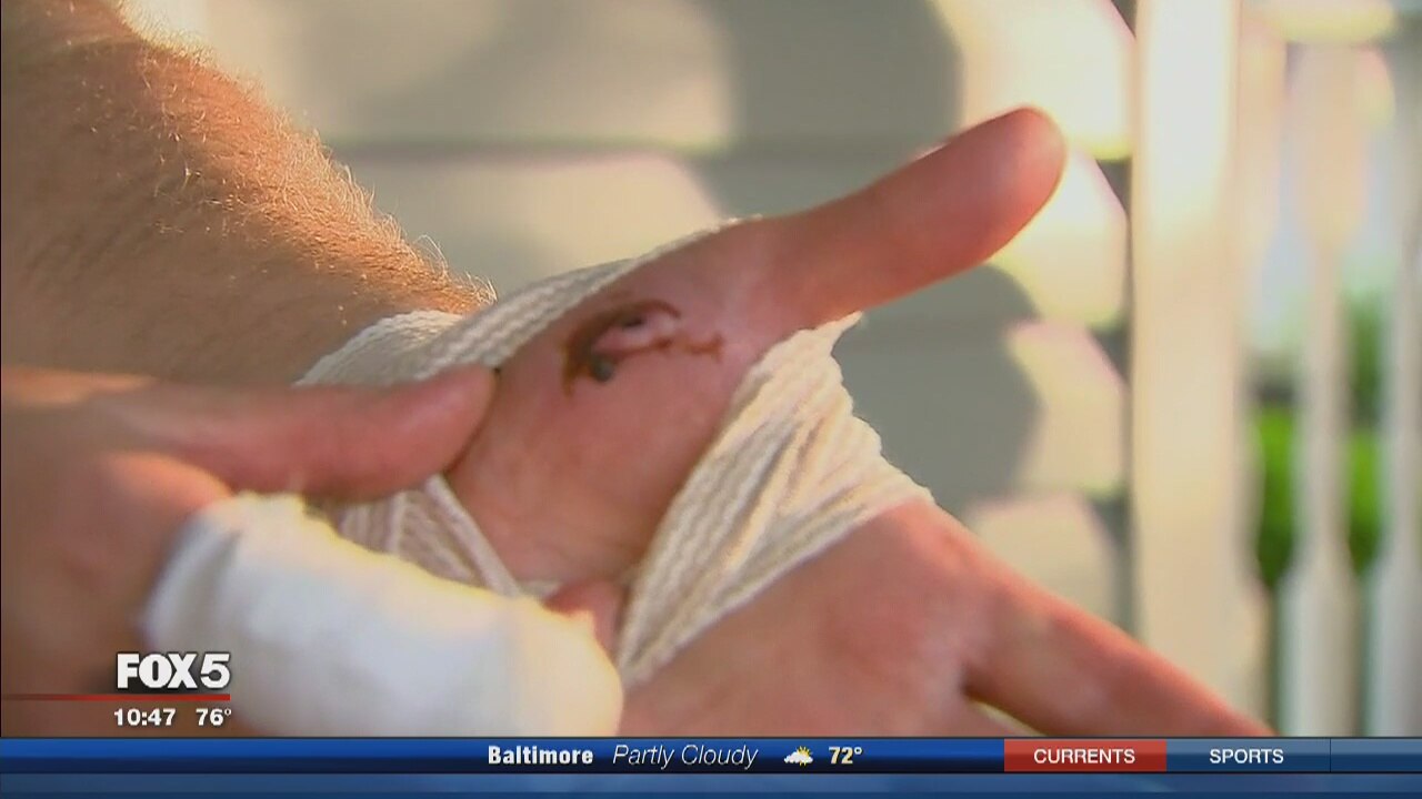 Man attacked by raccoon in Prince William County