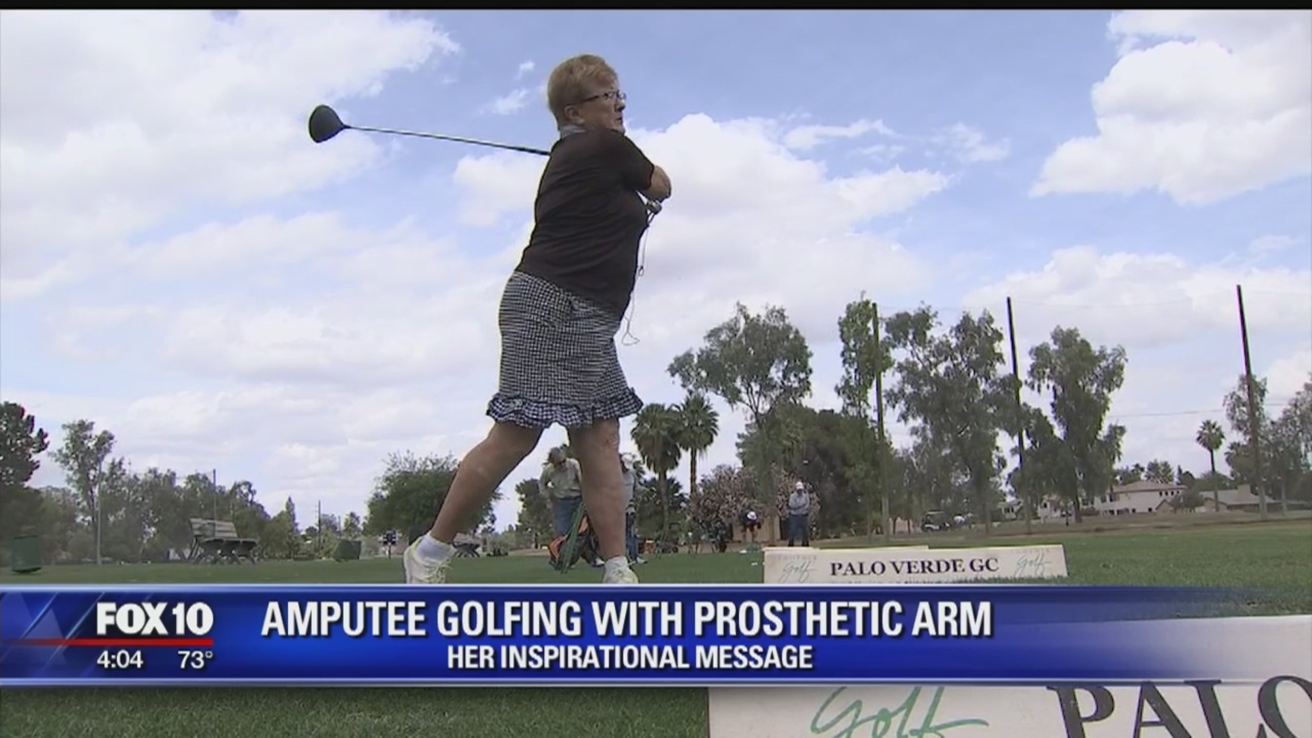 Valley woman able to continue playing golf with prosthetic arm