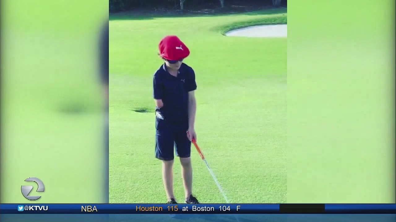 That Kid's Got Game: 'One Arm Golfer' also plays baseball and he hits home runs