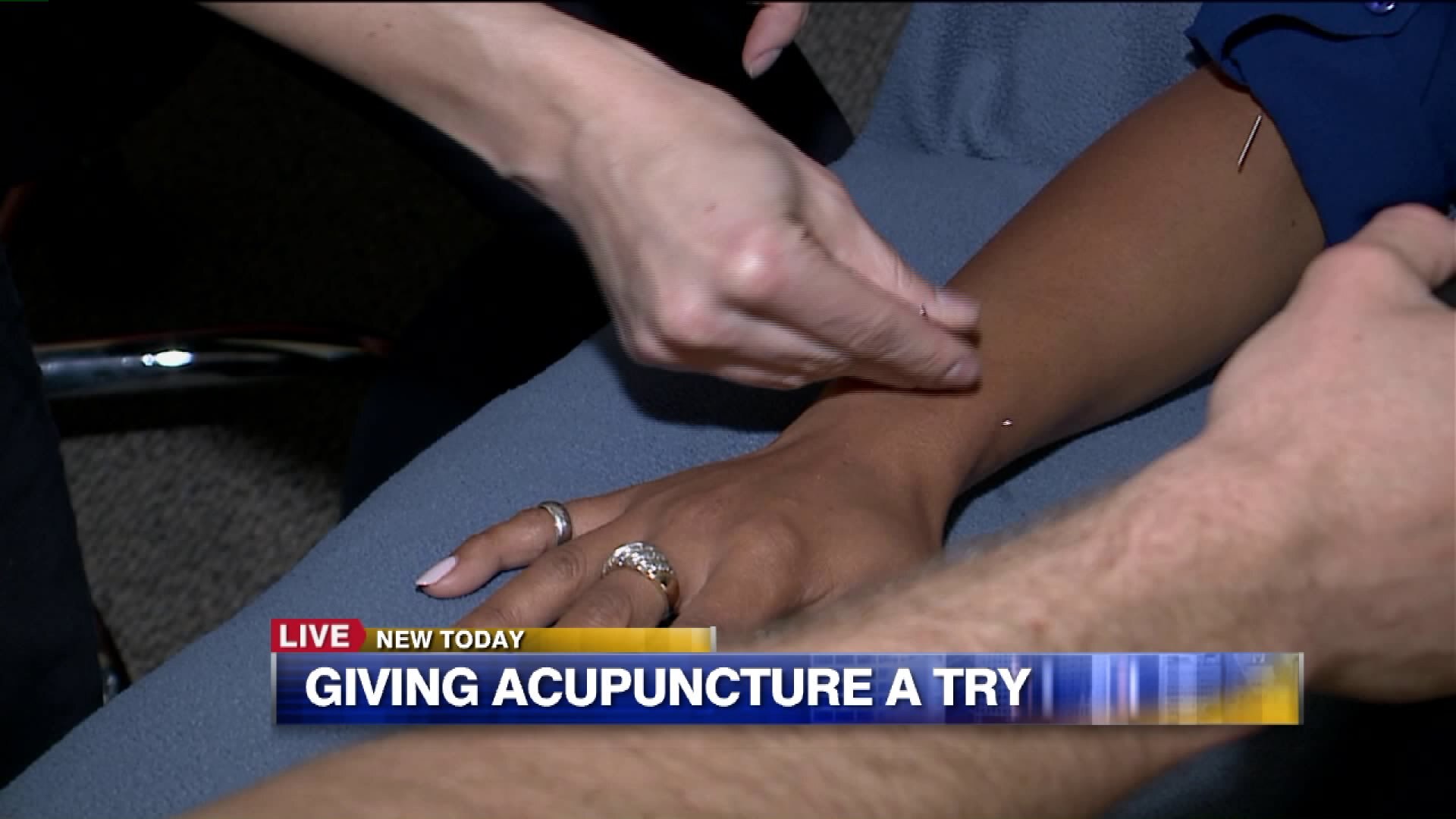 Carl learns about some of the health benefits of acupuncture