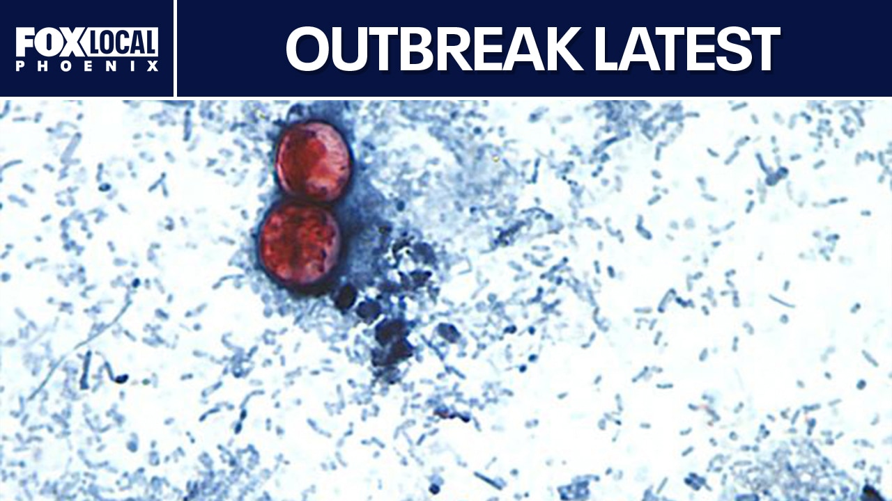 Cyclospora outbreak reaches 45 states