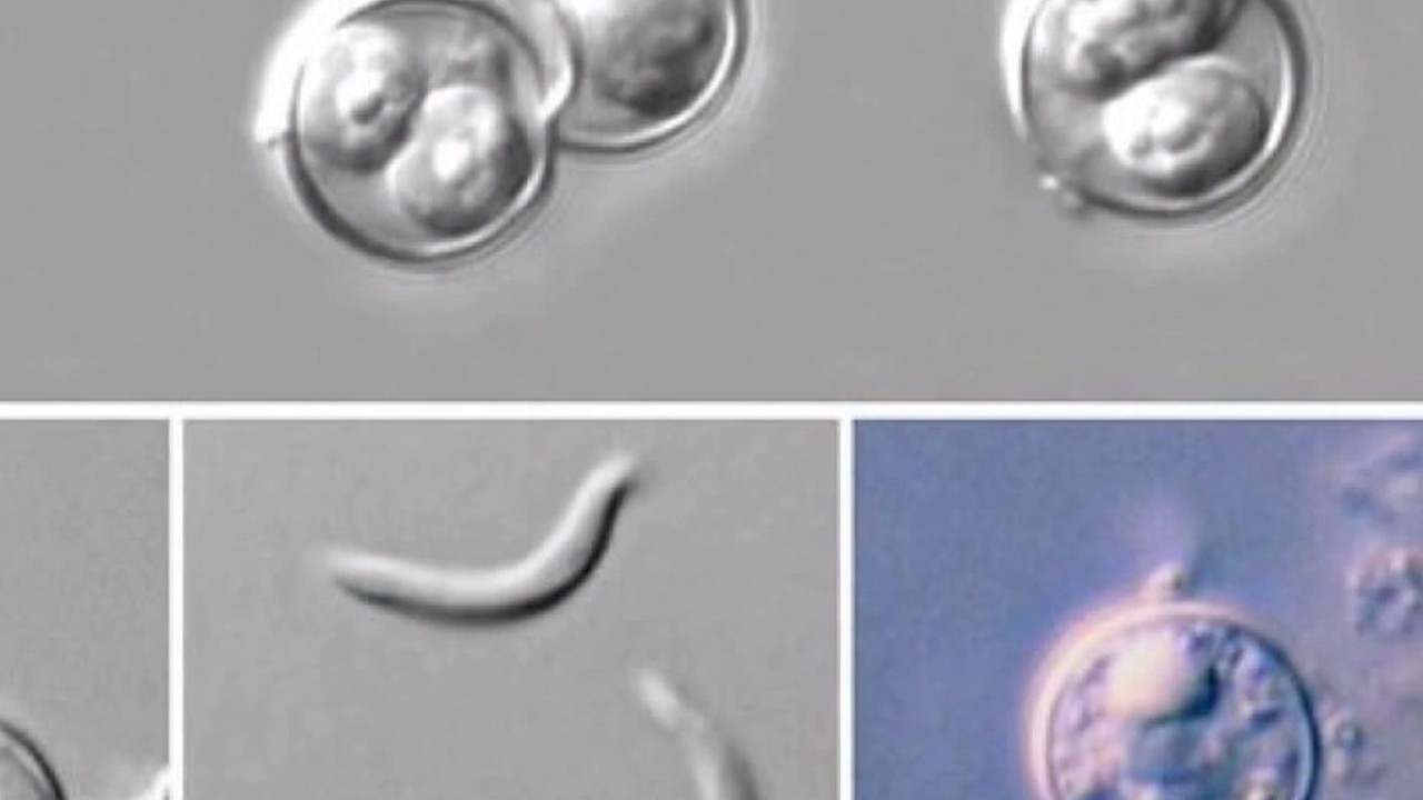 Cyclosporiasis outbreak: What to know as Illinois cases climb above 150