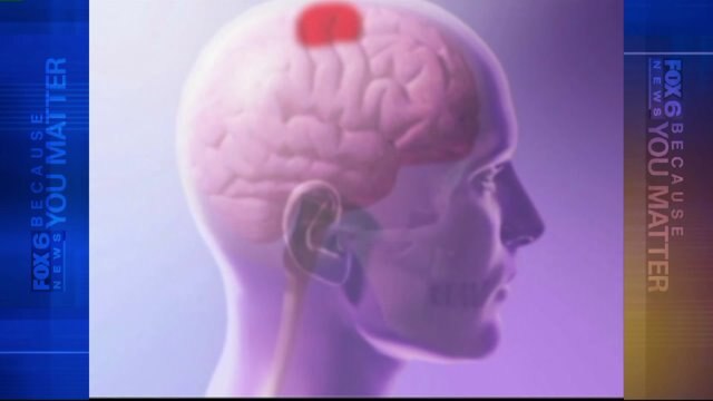 Kids & concussions: The warning signs, treatments that parents need to know about