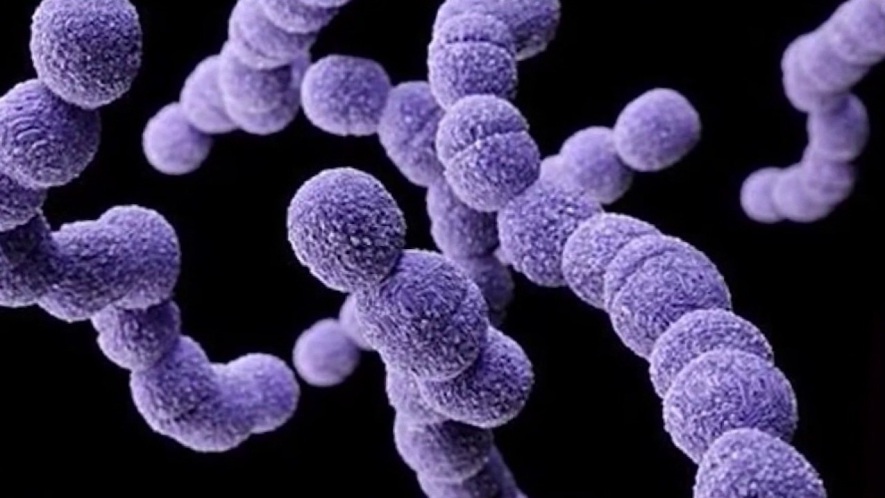 Flesh-eating bacteria kills Marion County resident