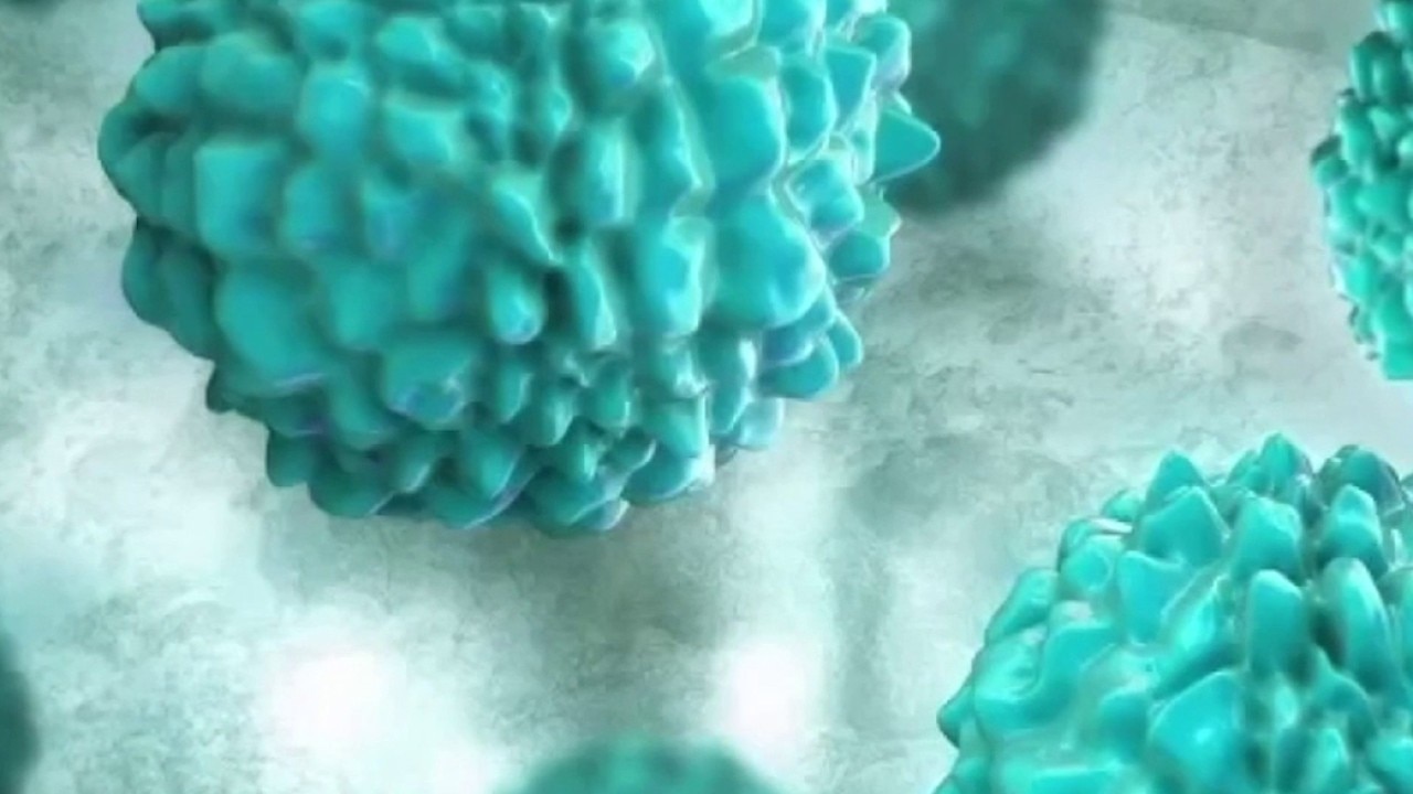 CDC investigates severe diarrhea parasite outbreak in 17 states