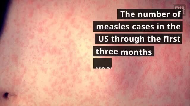 Measles cases on the rise