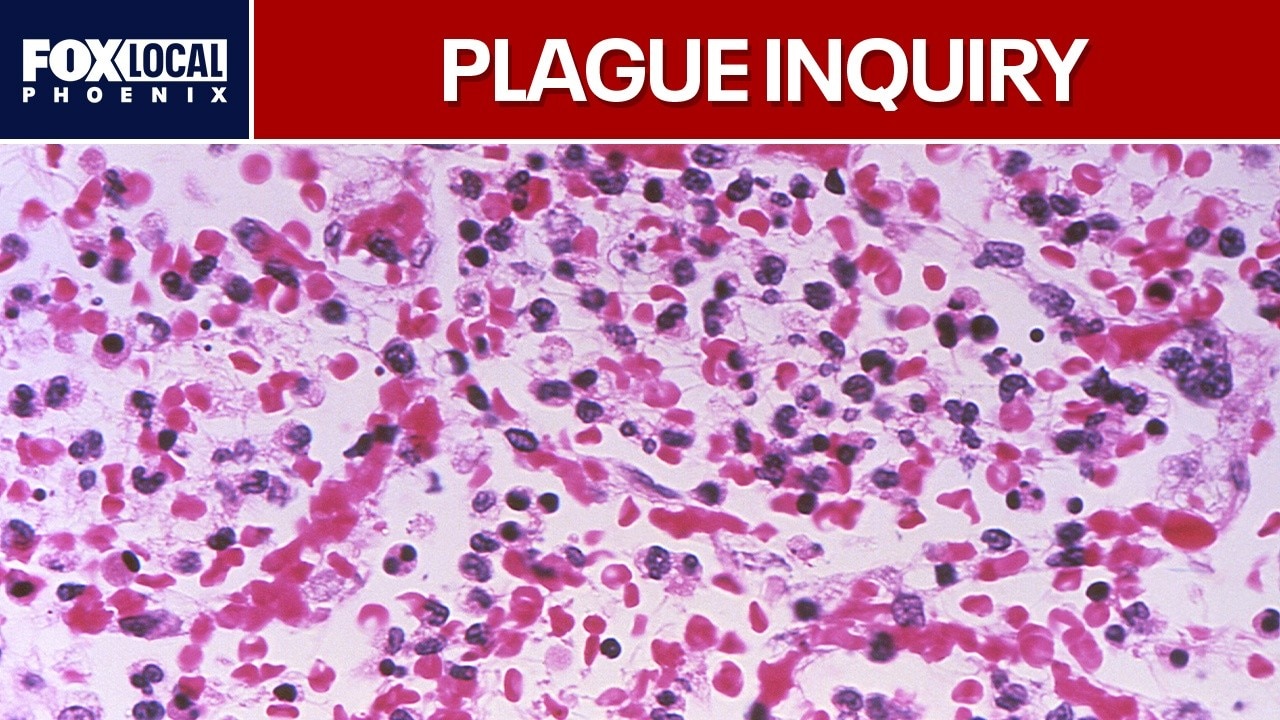 Questions mount over possible Russia plague death