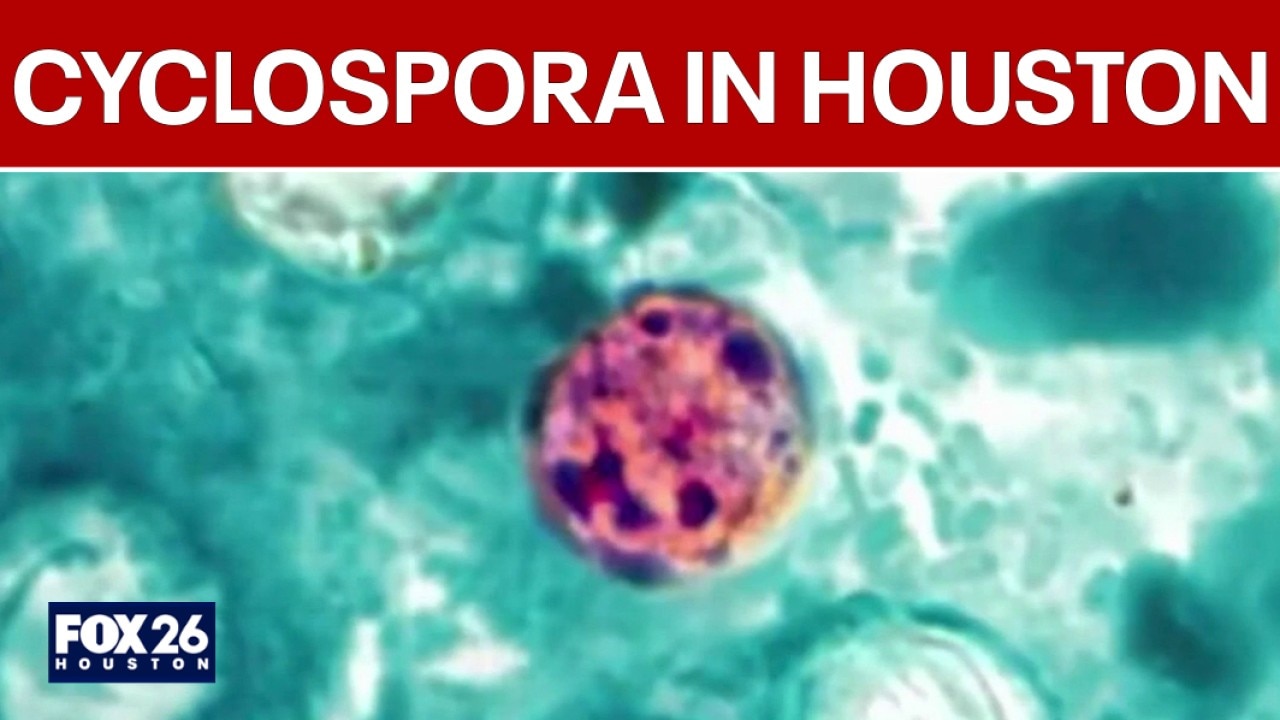 34 cases of cyclospora confirmed in Houston area