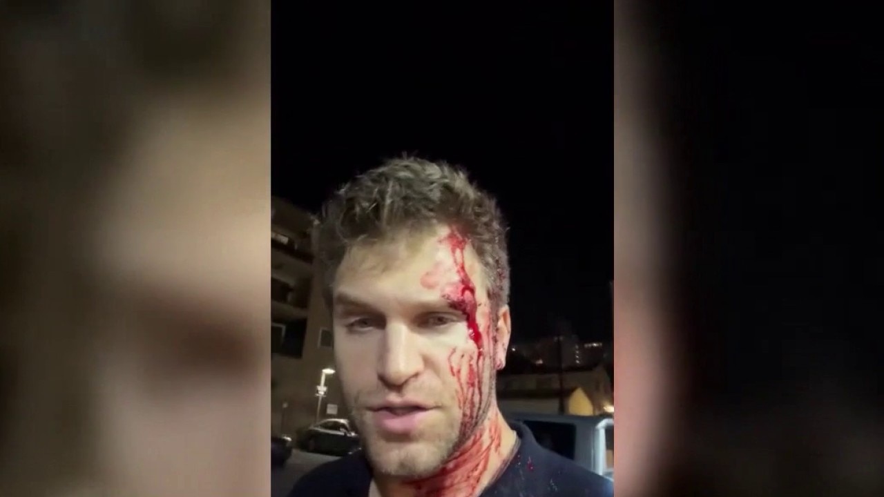 'Pretty Little Liars' actor attacked in LA robbery