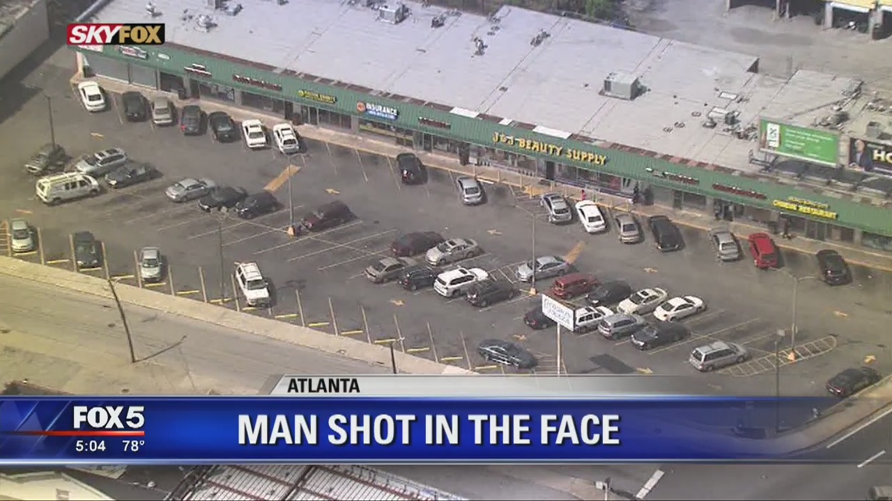 Man shot in the face