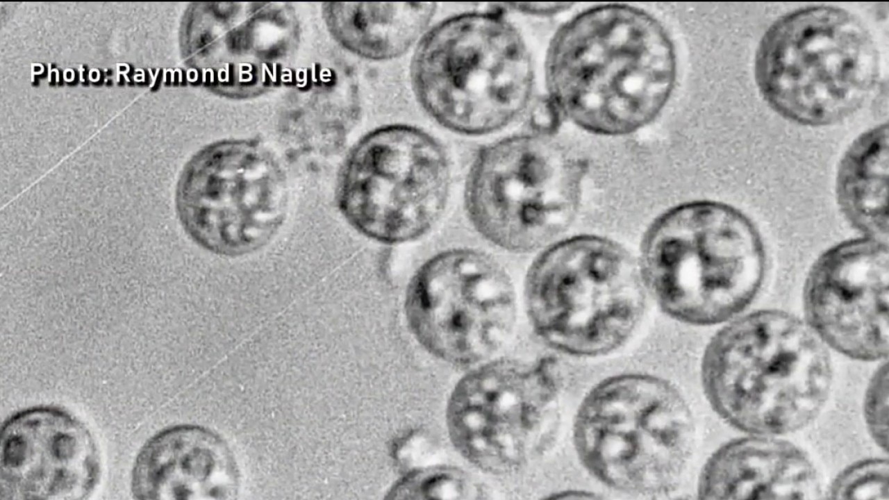 Illinois health expert breaks down rise of cyclosporiasis 