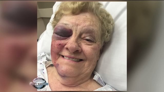 WANTED: Violent robbers who targeted, badly hurt elderly woman