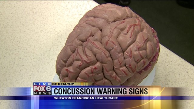What is a concussion? How do you know if someone has one?