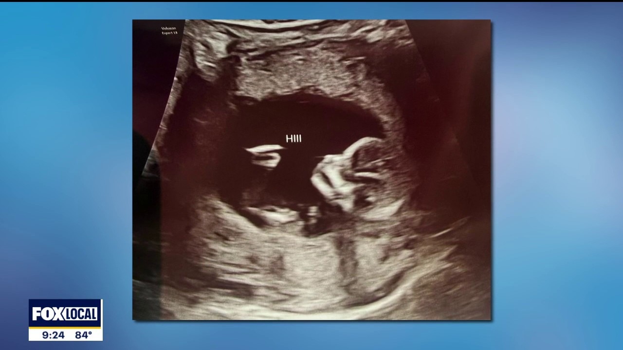 Surprise! Another FOX 4 anchor is expecting