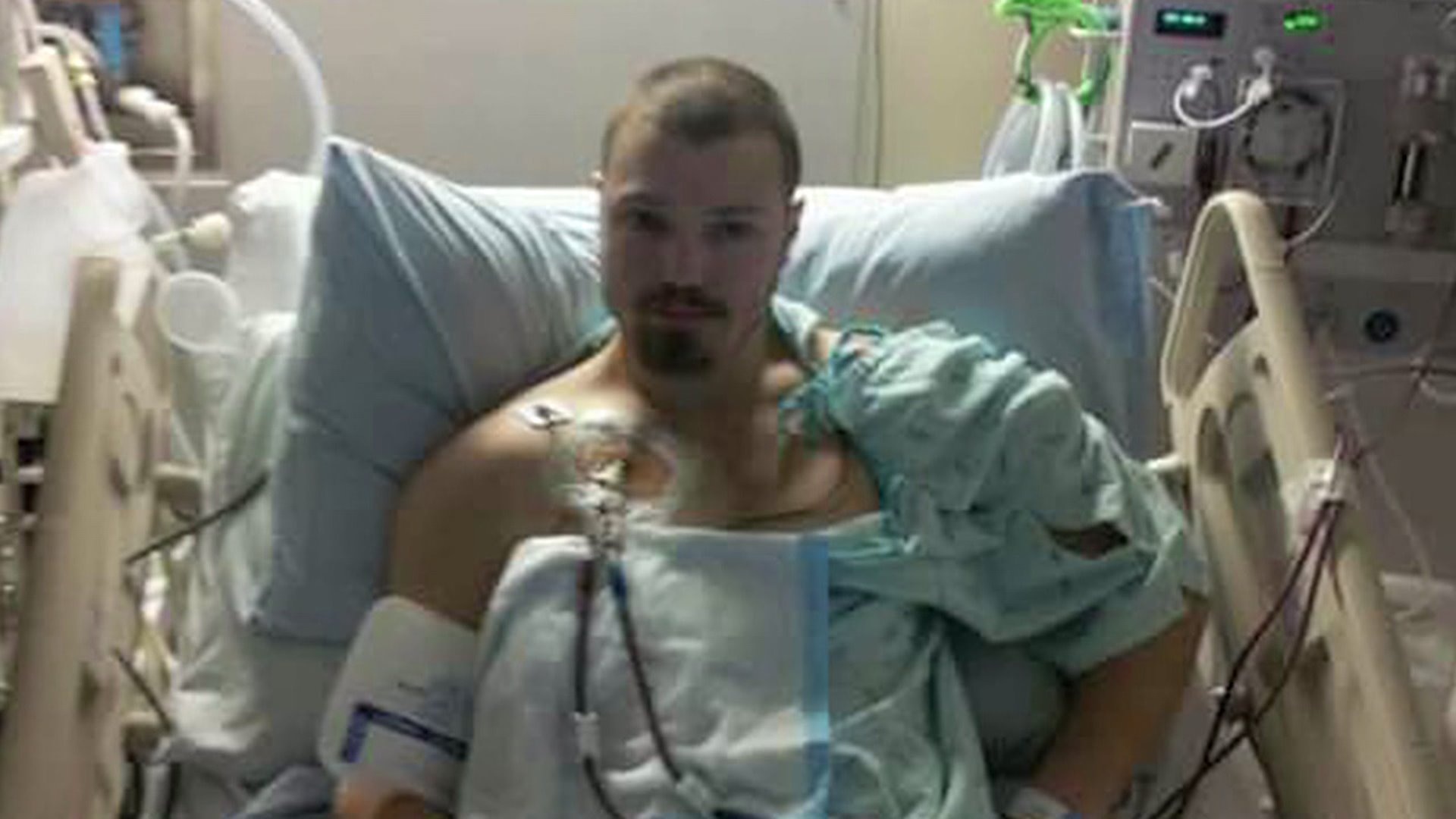 Kidney donation
