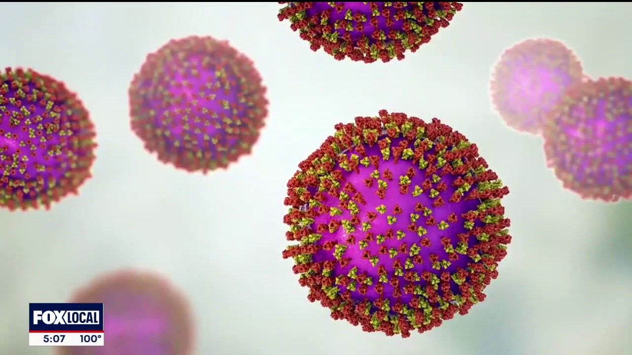 Dallas County reports first measles case of 2026