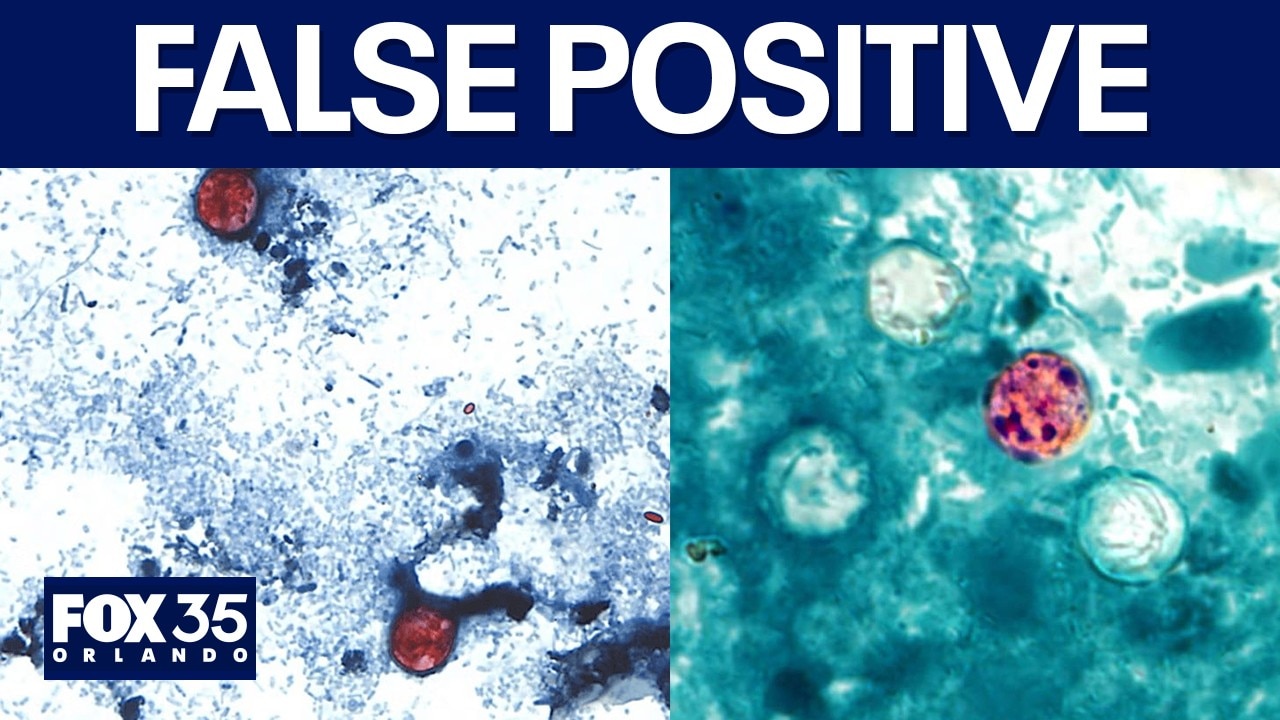 Taylor Farms cyclospora test false: What's the cause?