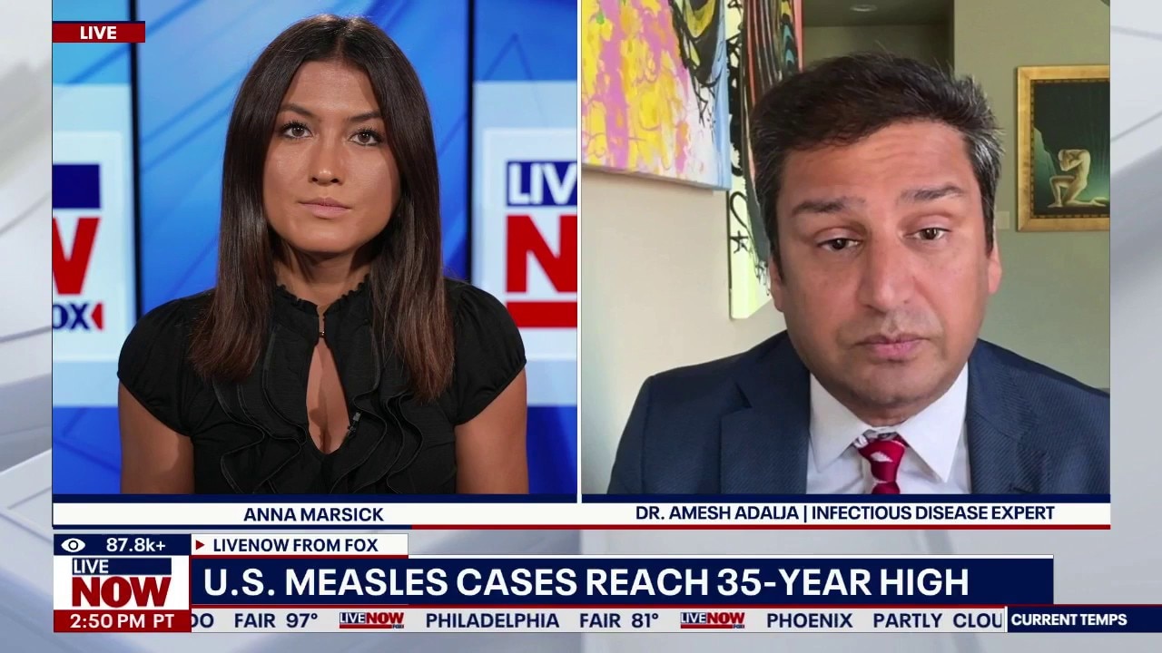 Number of U.S. measles cases surpasses 2025 total