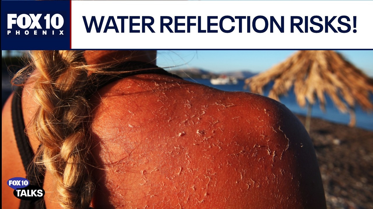 MD Warns: Pool hazards and hidden sunburn traps!