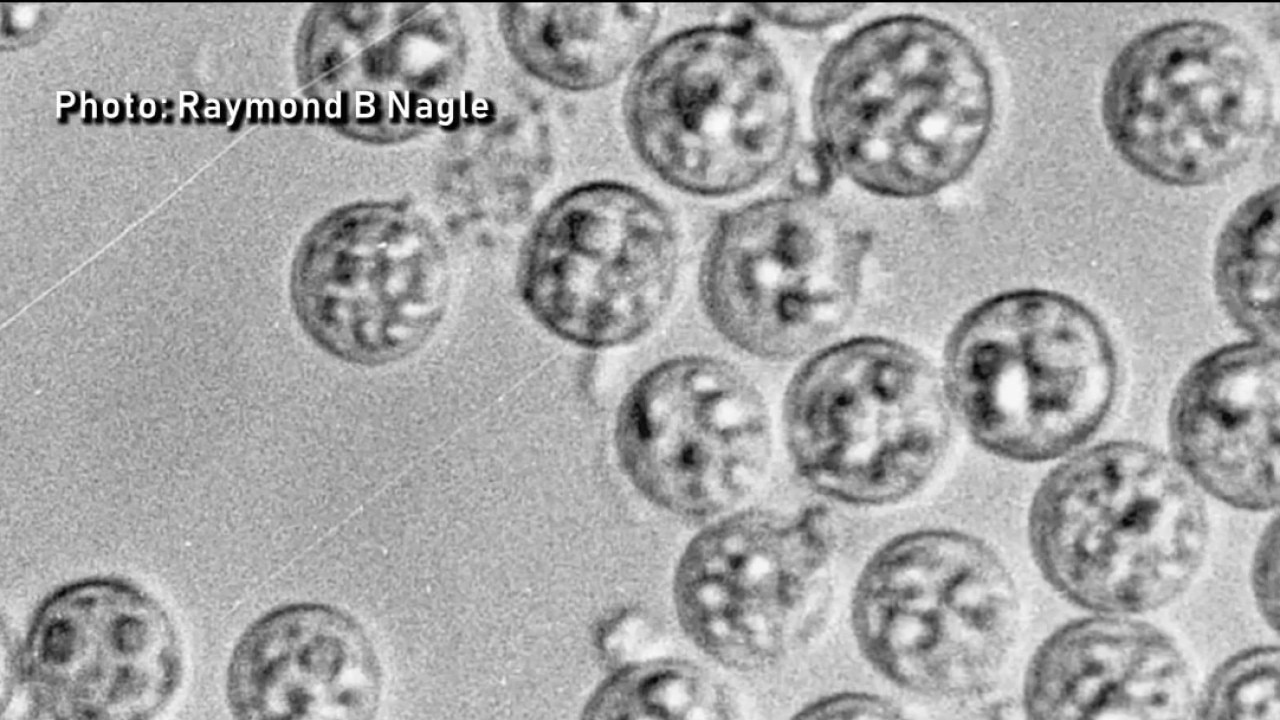 Cyclosporiasis outbreak continues in Illinois