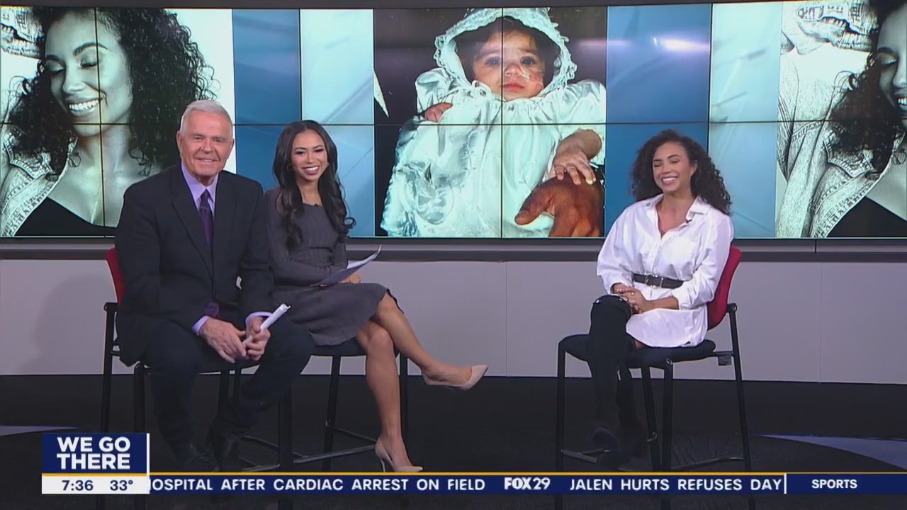 Congenital heart defect survivor discusses importance of loving the skin you're in