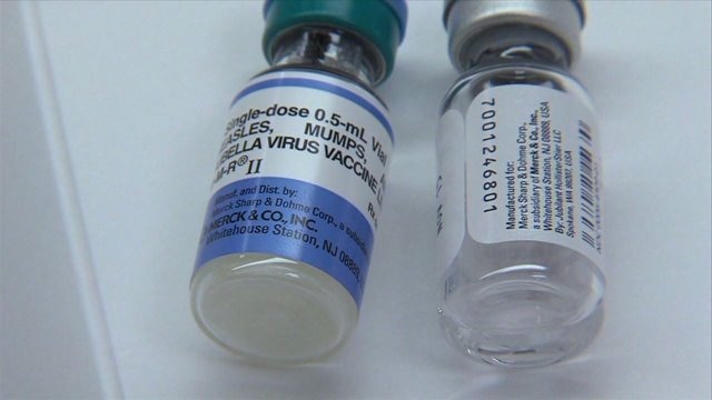 Mumps cases on the rise