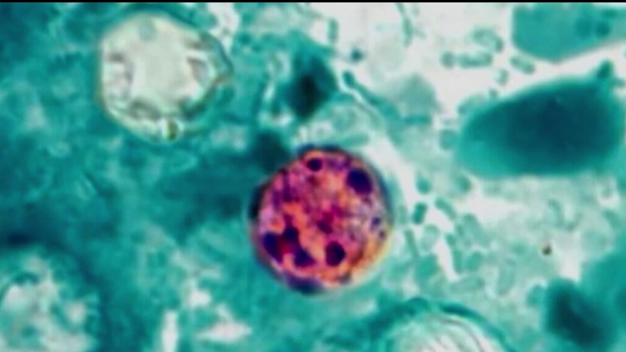FDA retracts Taylor Farms parasite alert after confirming false positive on iceberg lettuce