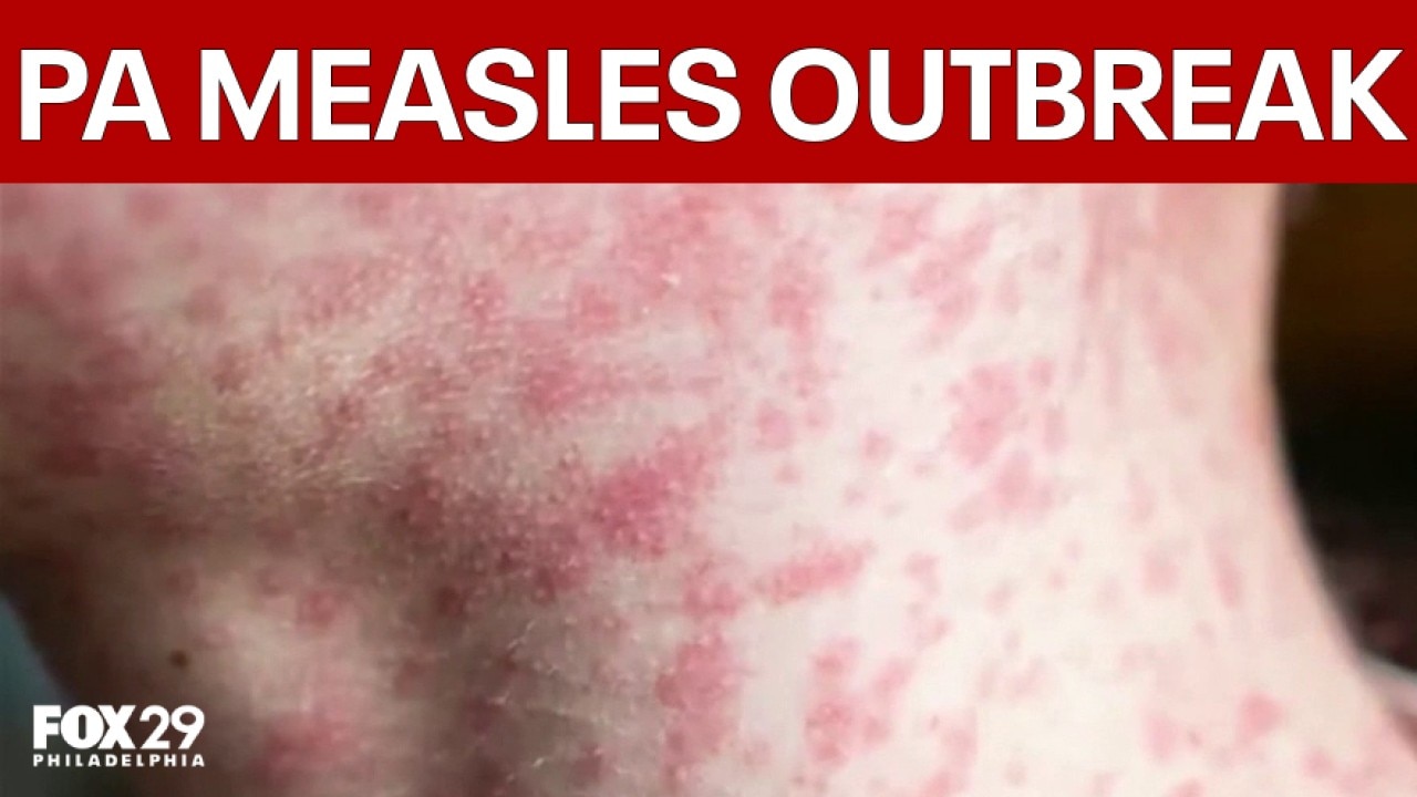 Pennsylvania faces largest measles outbreak since early 1990s