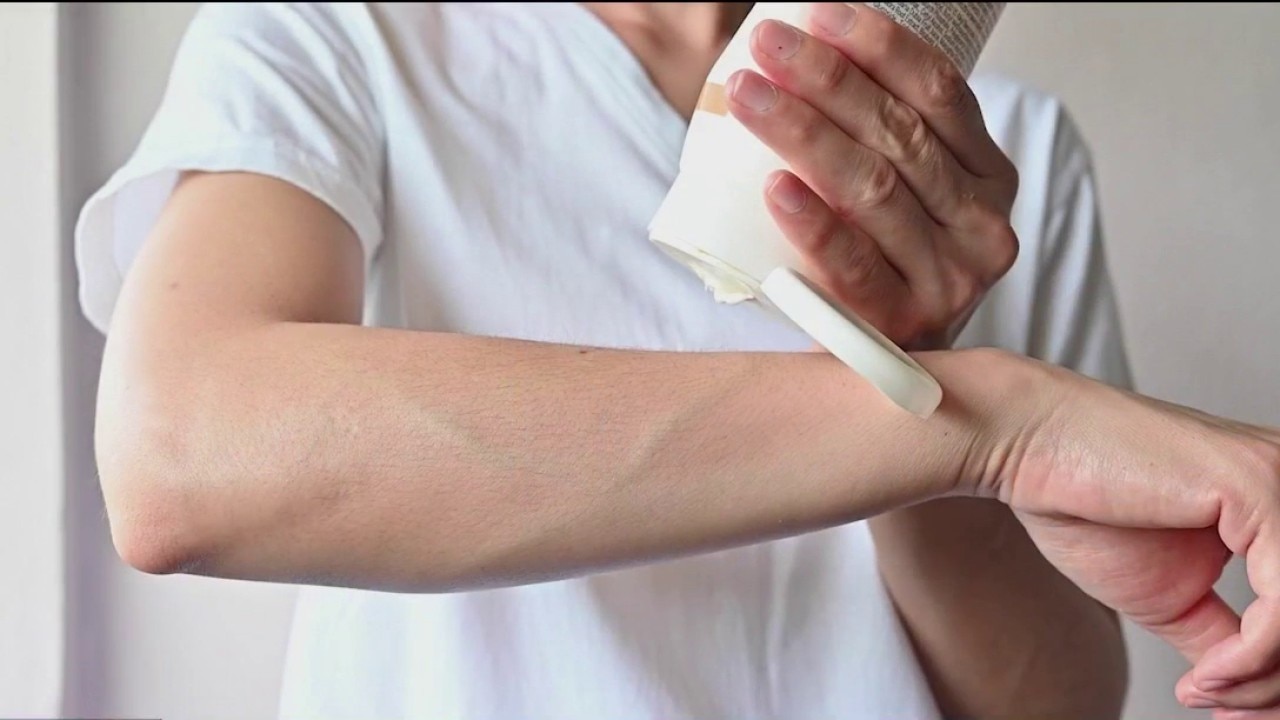 Experimental mRNA melanoma vaccine shows promise in landmark trial