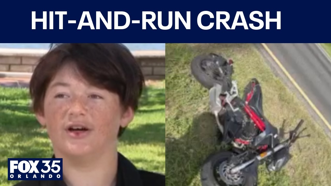 Motorcyclist, 20, recalls hit-and-run crash, recovers from several broken bones