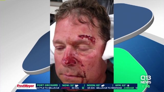 Officer injured in May Day announces claim against city