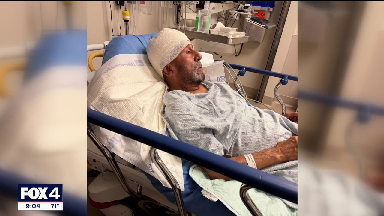 Suspect pistol whips elderly Dallas man during robbery