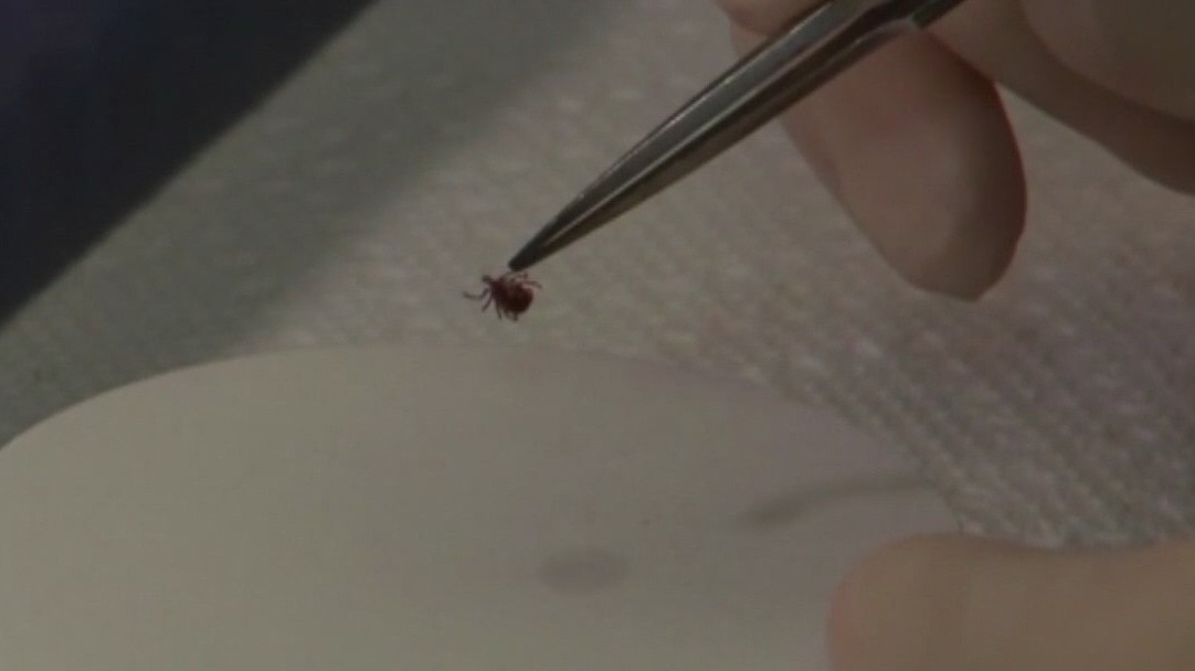 Tick bites linked to red meat allergies