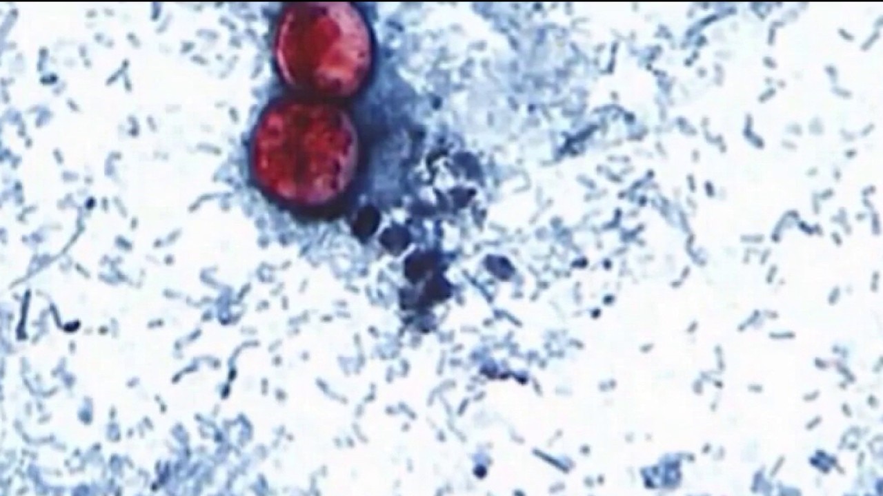 2 cyclospora deaths reported in Michigan | What you need to know 