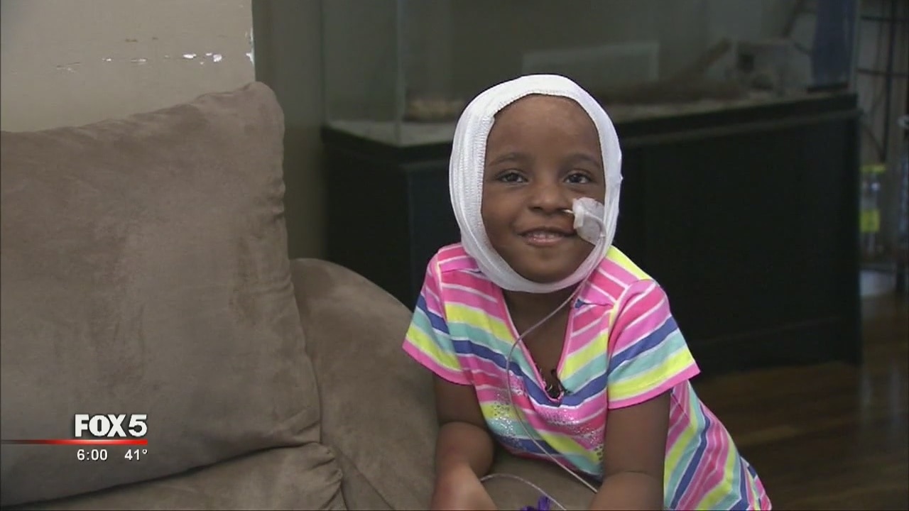 Girl recovering after dog attack