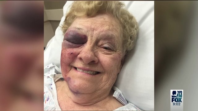 Grandmother attacked outside grocery store