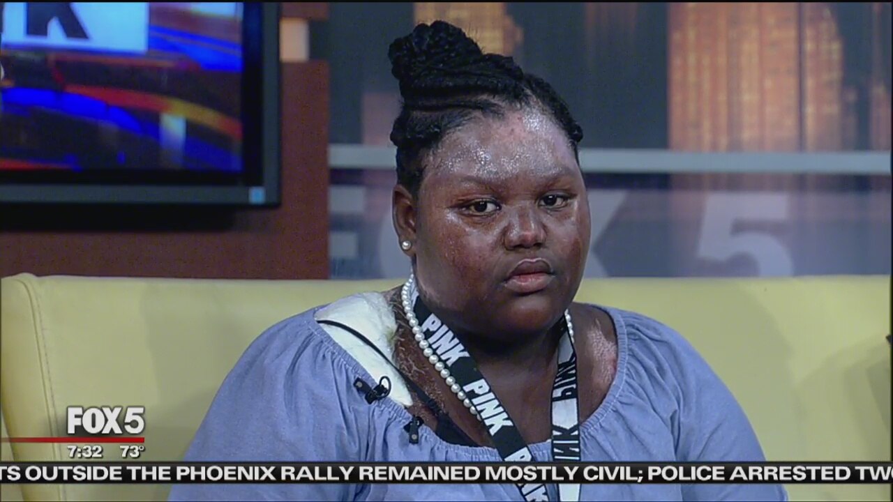 11-Year-Old Burned With Boiling Water Speaks Out