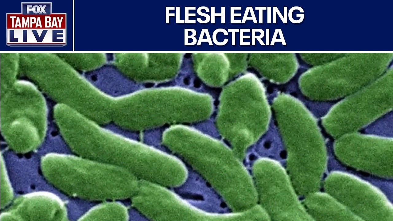 Flesh eating bacteria warning