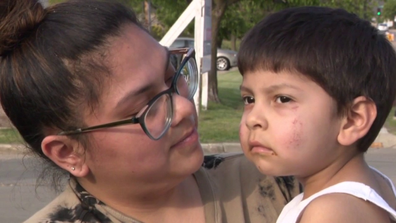 4-year-old hit by car while crossing street