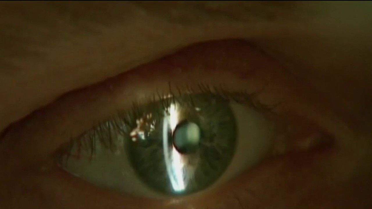 Eye exams can reveal warning signs of cancer, other health issues, doctor says