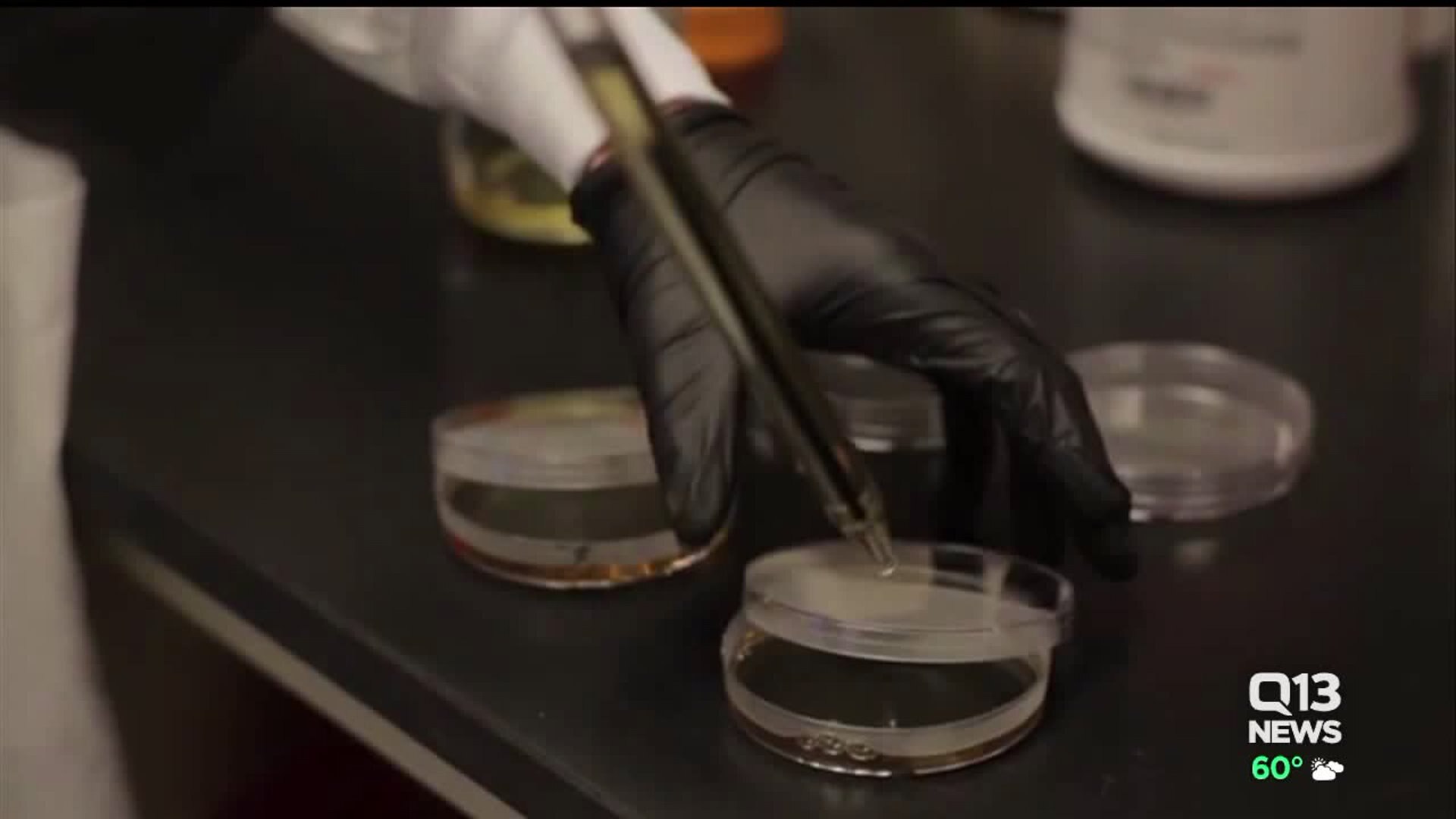 HIV Vaccine Research