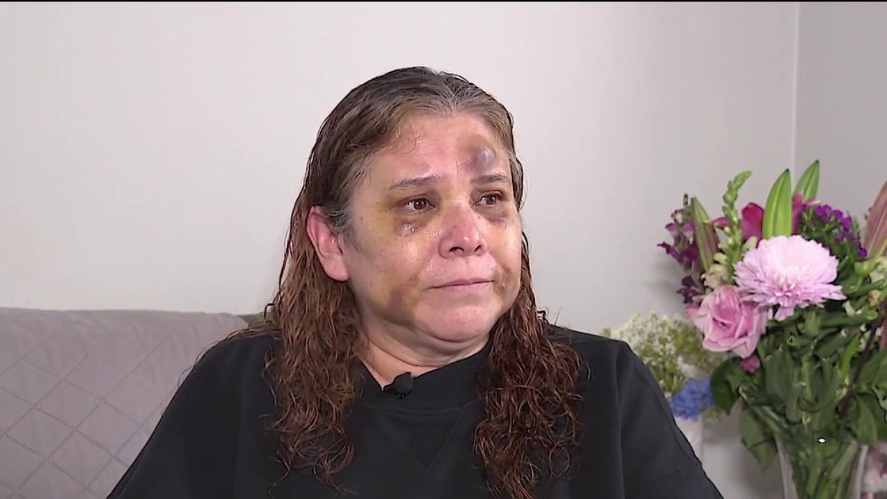 Woman attacked by accused killer of CPD officer speaks out