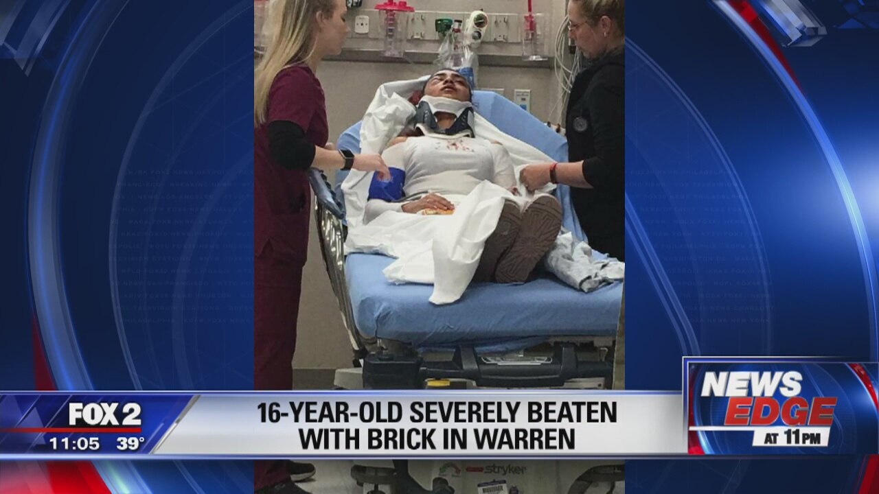 Warren teen with bone disease beaten with brick