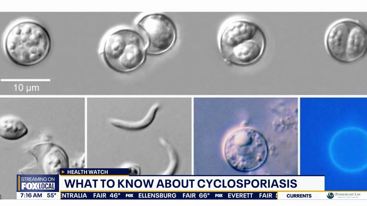 What to know about Cyclosporiasis: 42 cases in WA