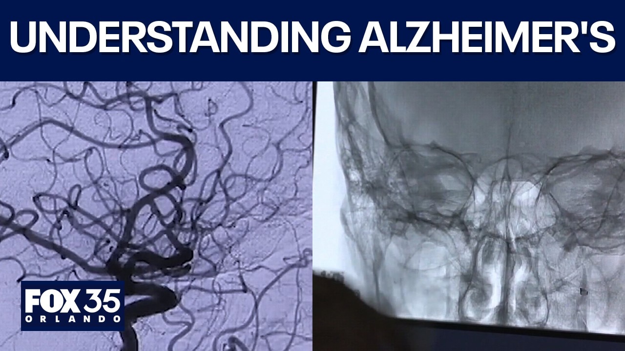 Recognizing Alzheimer's: Early signs & what to look for