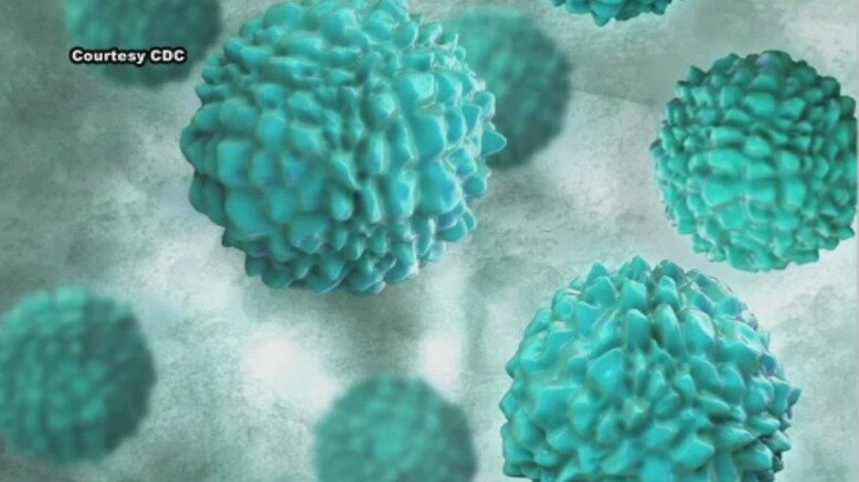 Reported uptick in Norovirus cases