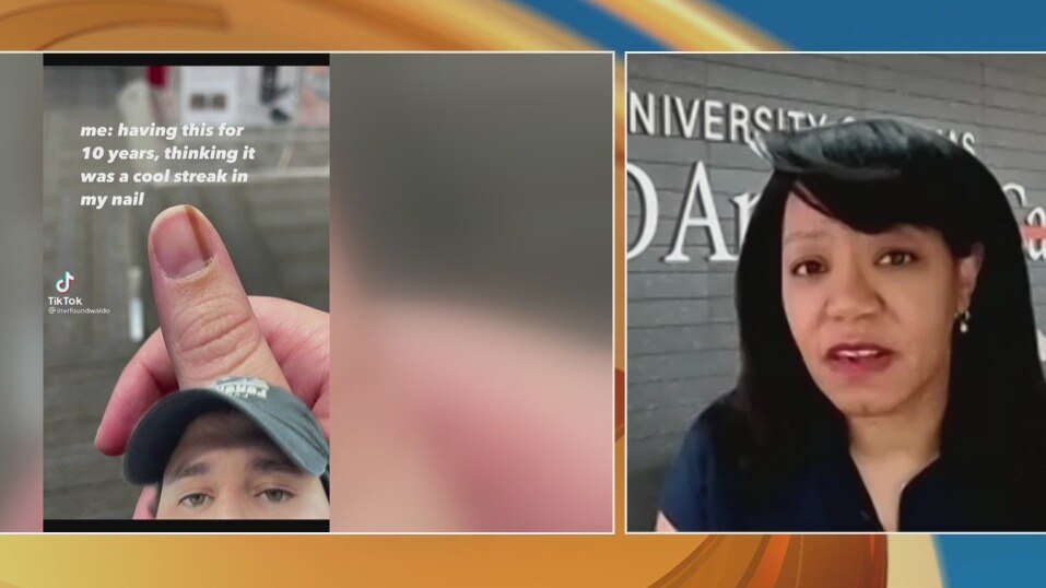 Woman's viral TikTok warns others about a potential sign of cancer